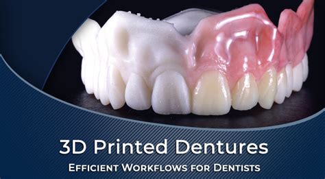 3d printed dentures reviews|(PDF) A Systemic review of 3D printed complete denture.